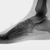 Wilk-PTI-Online-Anatomy-of-the-Foot-and-Ankle-Complex-By-David-Nolan-free-download